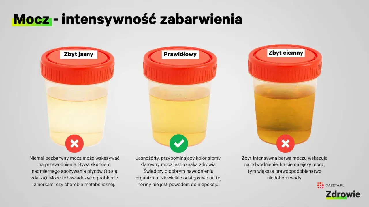 Trzy próbki moczu: zbyt jasny (może oznaczać przewodnienie lub problemy z nerkami), prawidłowy (jasnożółty, oznaka zdrowia) i zbyt ciemny (wskazuje na odwodnienie).