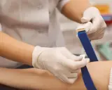 Pielęgniarka zakłada opaskę uciskową na ramię pacjenta przed pobraniem krwi. Badanie poziomu mocznika pomoże ocenić rokowania.