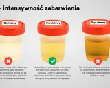 Trzy próbki moczu: zbyt jasny (może oznaczać przewodnienie lub problemy z nerkami), prawidłowy (jasnożółty, oznaka zdrowia) i zbyt ciemny (wskazuje na odwodnienie).