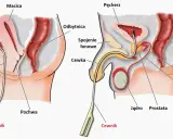 Ilustracja przedstawia cewnikowanie pęcherza moczowego u kobiet i mężczyzn, co może być pomocne przy problemach z zaleganiem moczu.