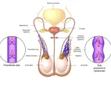 Anatomia jąder z widocznymi żyłami powrózka nasiennego. Po prawej stronie widok poszerzonej żyły, co może być jednym z objawów zapalenia jądra u dziecka.