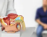 Lekarz pokazuje model układu moczowo-płciowego, wyjaśniając pacjentowi, co oznacza PSA 10.