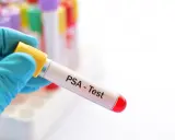 Ręka w niebieskiej rękawiczce trzyma probówkę z napisem "PSA - Test". To kluczowy krok w diagnostyce, który może pomóc w zrozumieniu, jak obniżyć psa prostaty.