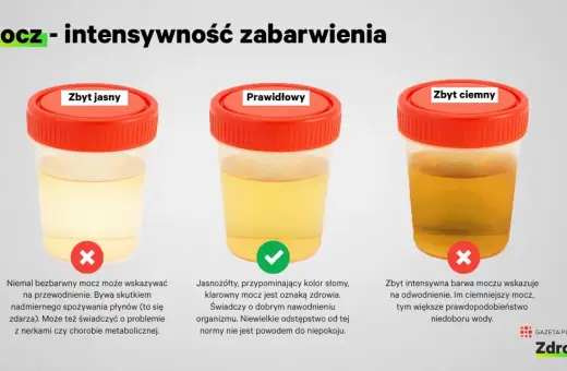 Trzy próbki moczu: zbyt jasny (może oznaczać przewodnienie lub problemy z nerkami), prawidłowy (jasnożółty, oznaka zdrowia) i zbyt ciemny (wskazuje na odwodnienie).