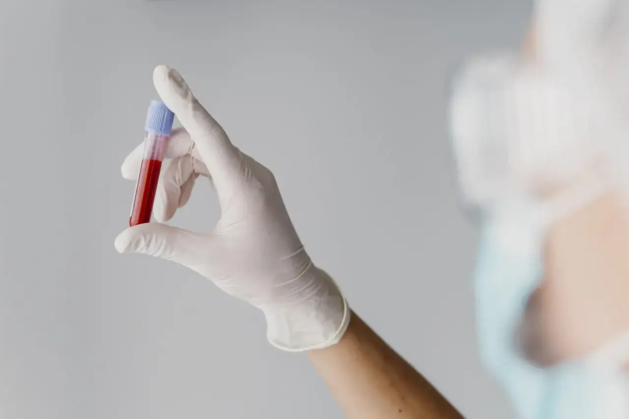 Ręka w rękawiczce trzyma probówkę z krwią. To może być część diagnostyki, np. jakie badania krwi do urologa.
