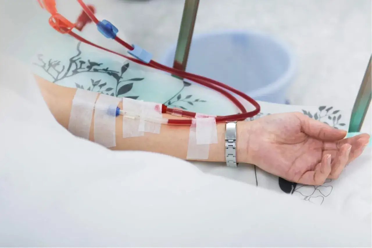 Ramię pacjenta z przetoką do dializ, gotowe do zabiegu. Wszelkie powikłania są monitorowane.