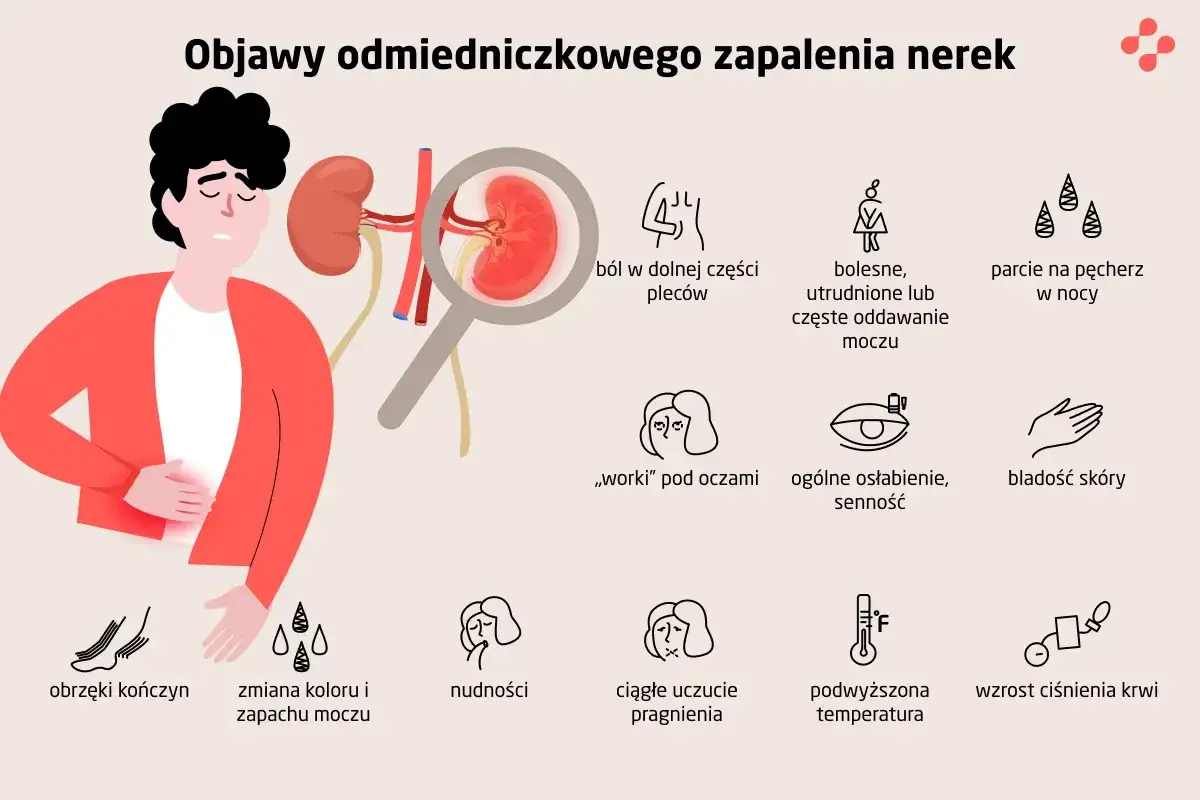 Ilustracja przedstawia objawy uszkodzenia nerek: ból pleców, problemy z oddawaniem moczu, obrzęki, nudności, gorączkę i inne.
